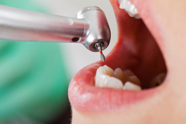 Best Emergency Dental Care for Trauma or Injury in Governors Village, NC